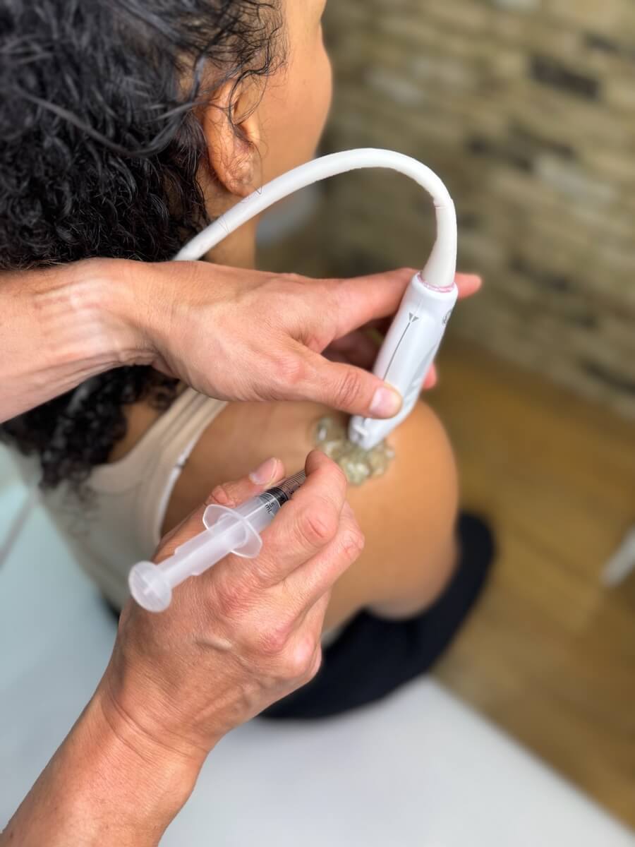 Cortico-Steroid Injections